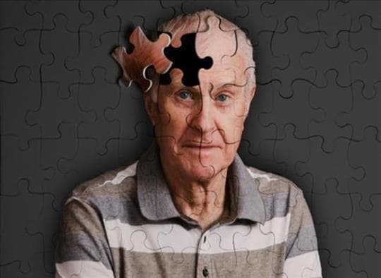 Тяжелая деменция - Альцгеймер